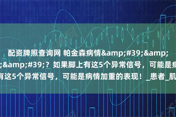 配资牌照查询网 帕金森病情&#39;&#39;脚先知&#39;&#39;？如果脚上有这5个异常信号，可能是病情加重的表现！_患者_肌肉_影响